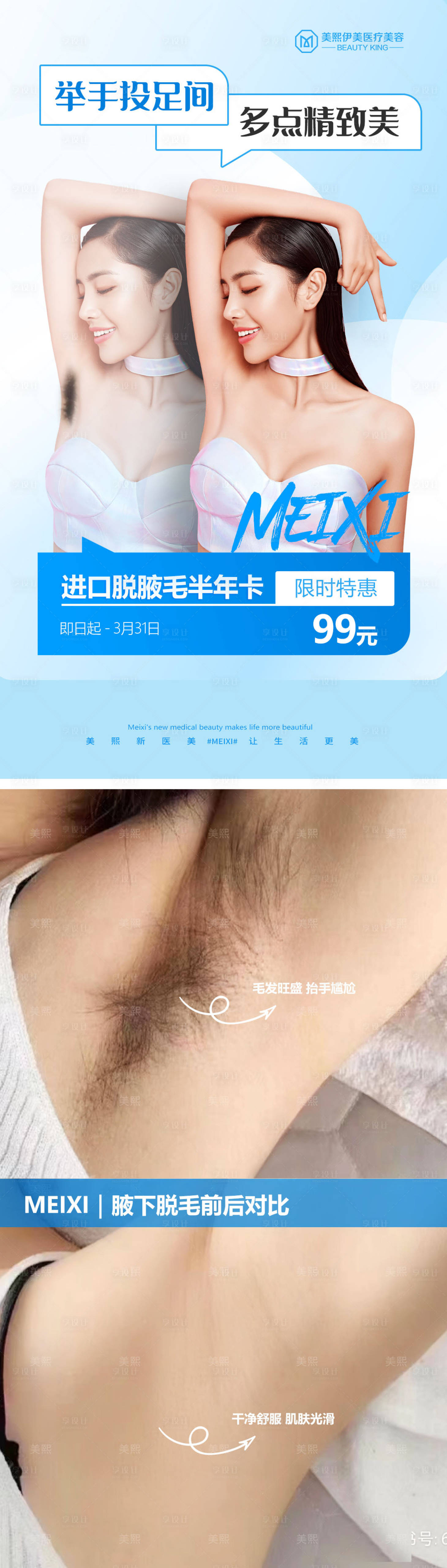 源文件下載【享設(shè)計】搜索編號：39540015329152740【脫毛年卡】
