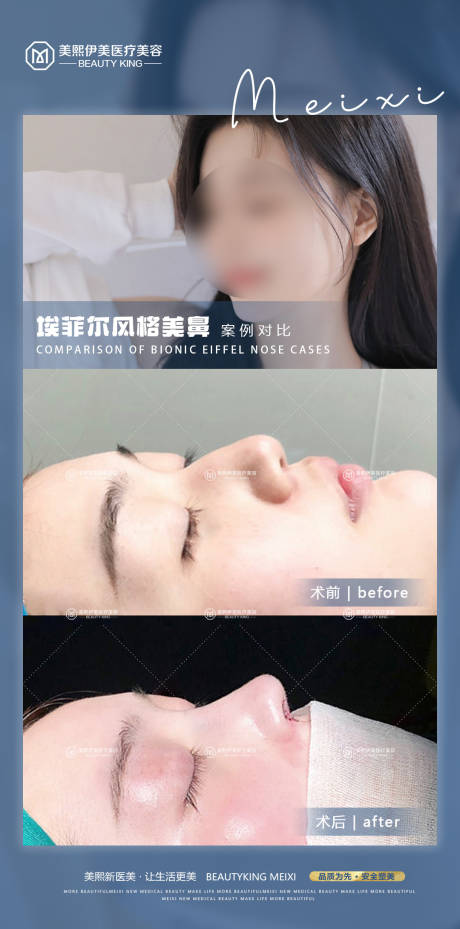 医美案例对比图海报 