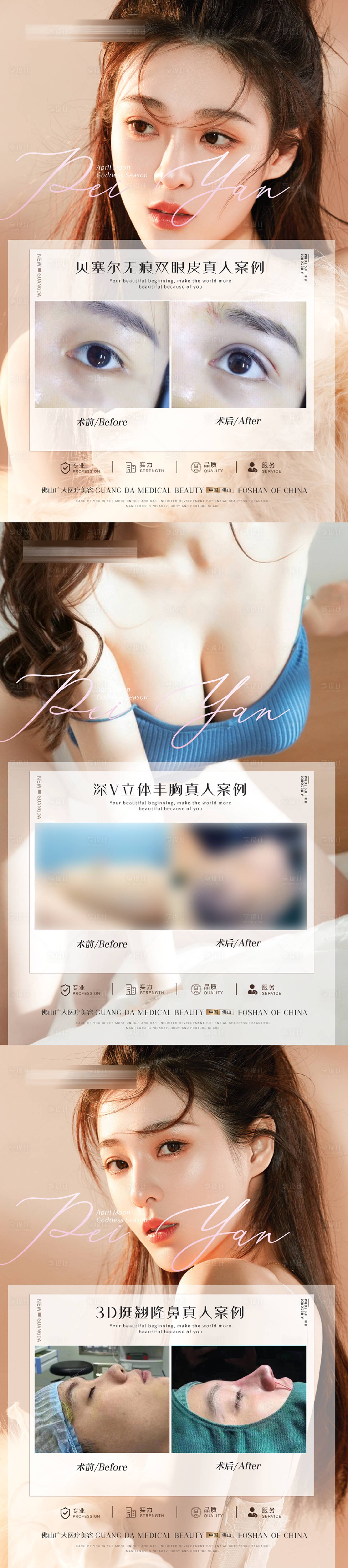 源文件下載【享設(shè)計】搜索編號：22390011244504157【醫(yī)美案例系列海報】