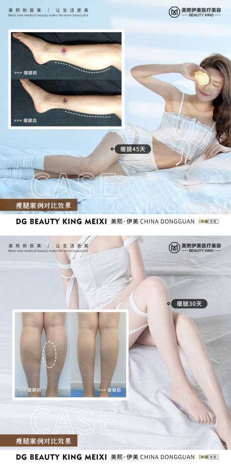 源文件下载【享设计】搜索编号：71760015338707090【瘦腿案例】