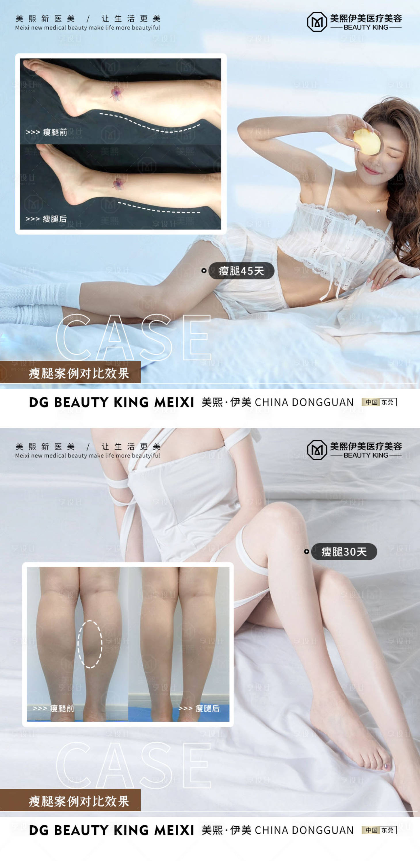 源文件下载【享设计】搜索编号：71760015338707090【瘦腿案例】