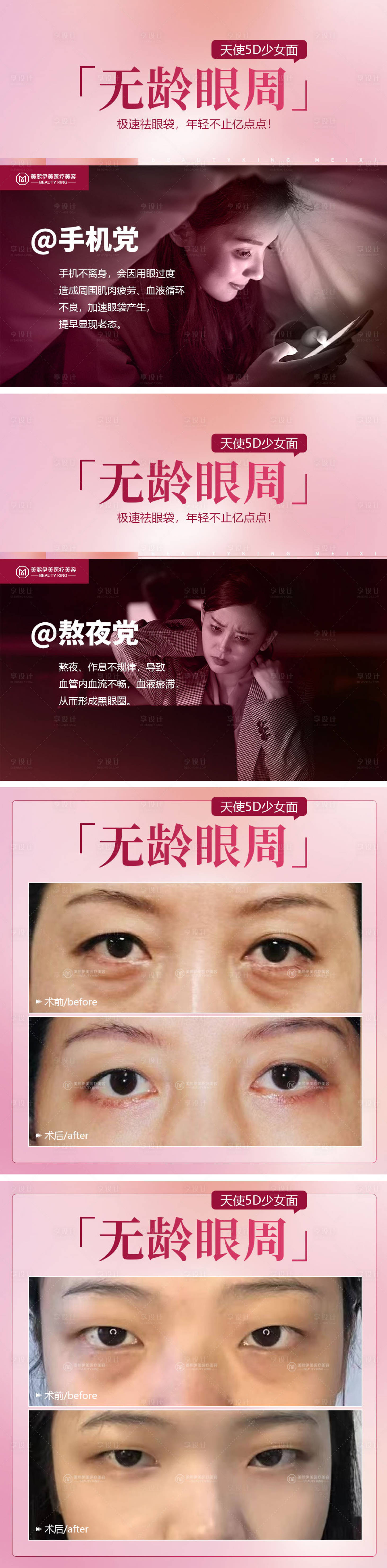 源文件下載【享設計】搜索編號：20890015383142062【醫美眼周年輕化長圖海報】
