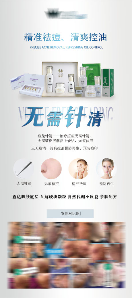 源文件下载【祛痘产品展架】编号：74720015584305137