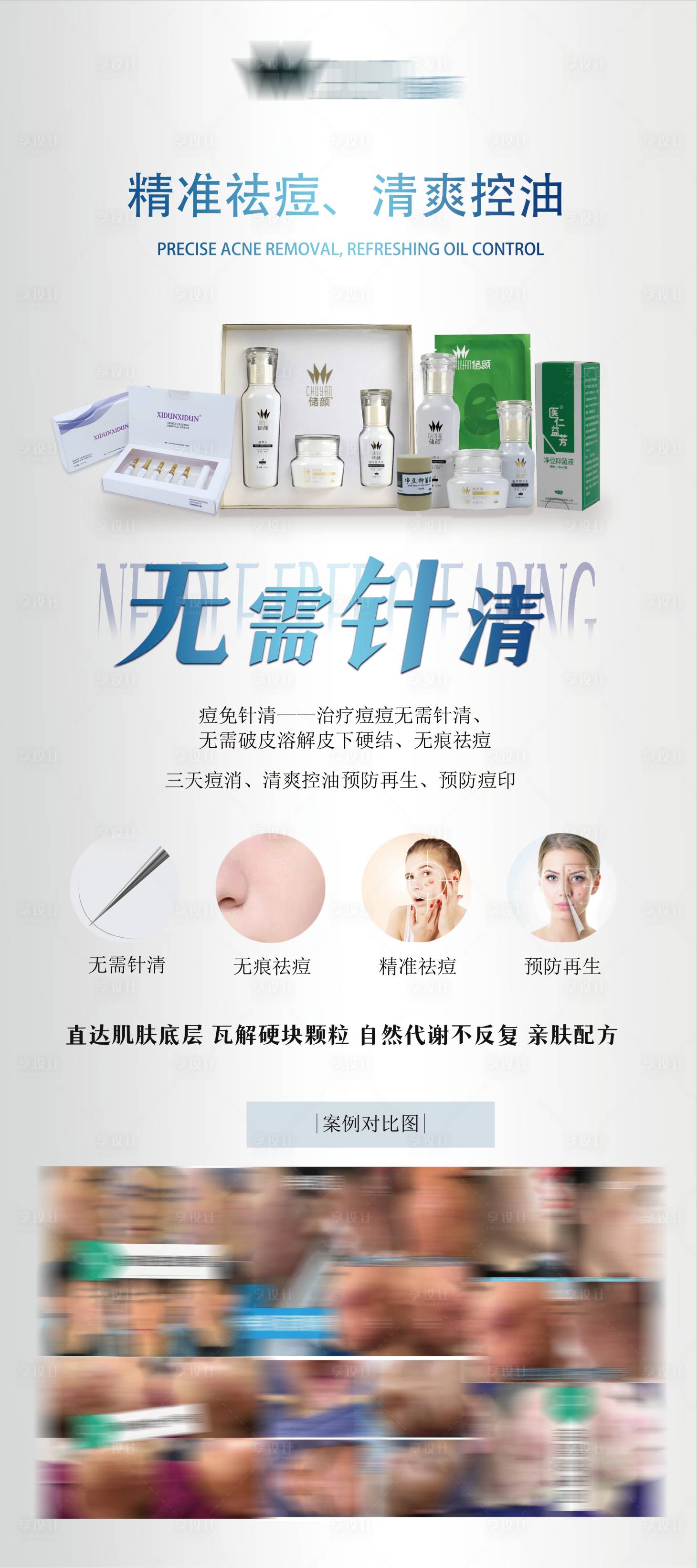 源文件下載【享設(shè)計】搜索編號：74720015584305137【祛痘產(chǎn)品展架】