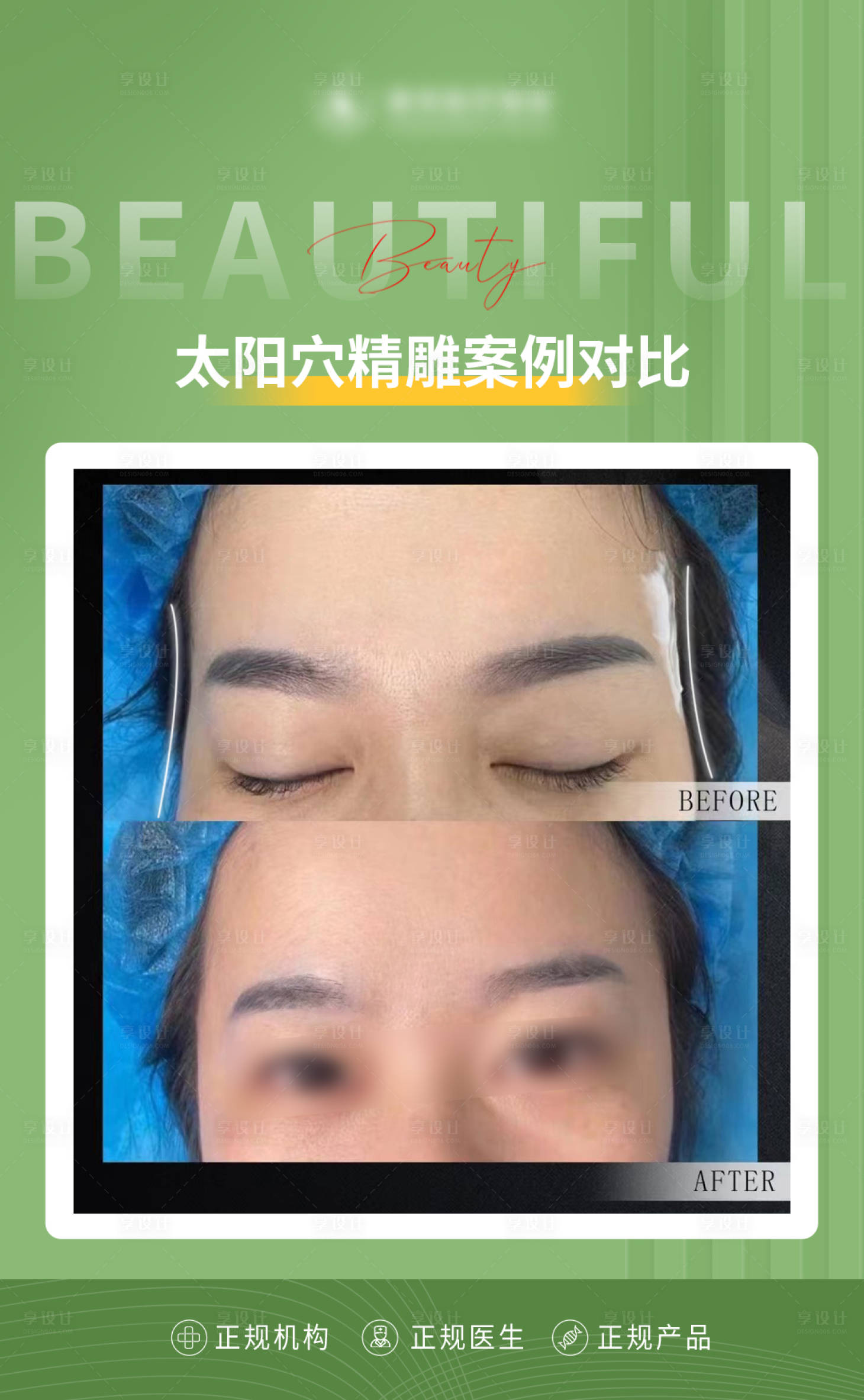 源文件下载【享设计】搜索编号：33050015624081942【医美案例对比海报】