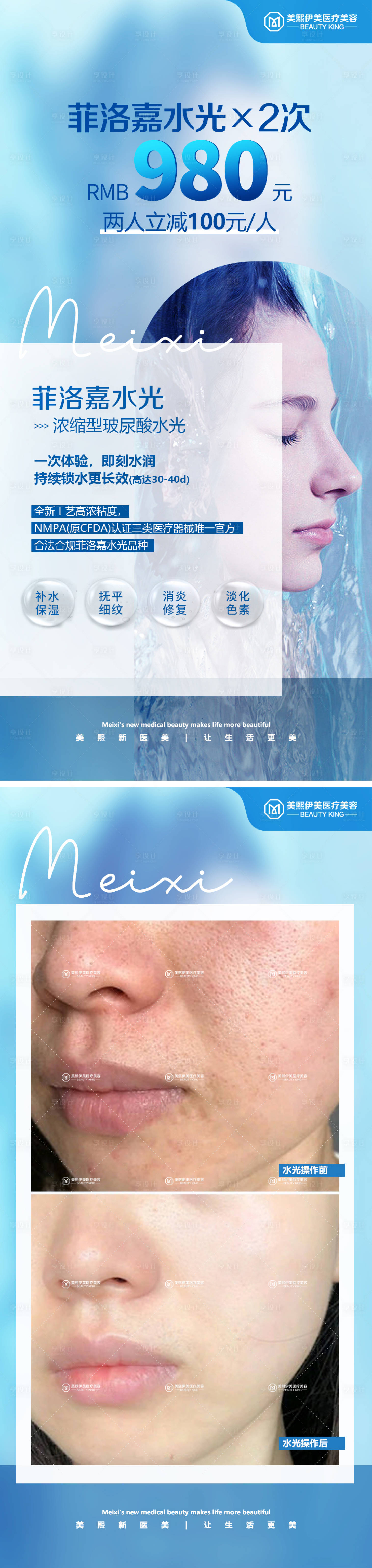 源文件下载【医美菲洛嘉水光针海报】编号：66600015356616923