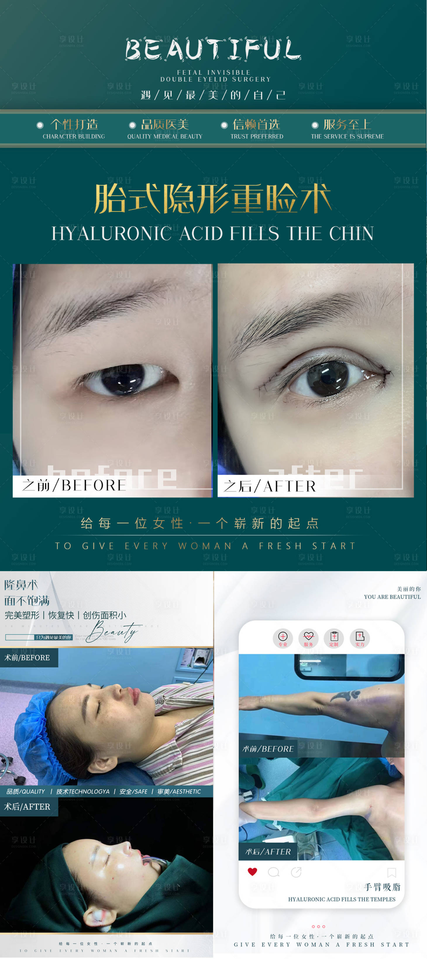 源文件下载【享设计】搜索编号：92860015562734987【医美案例对比图海报 】