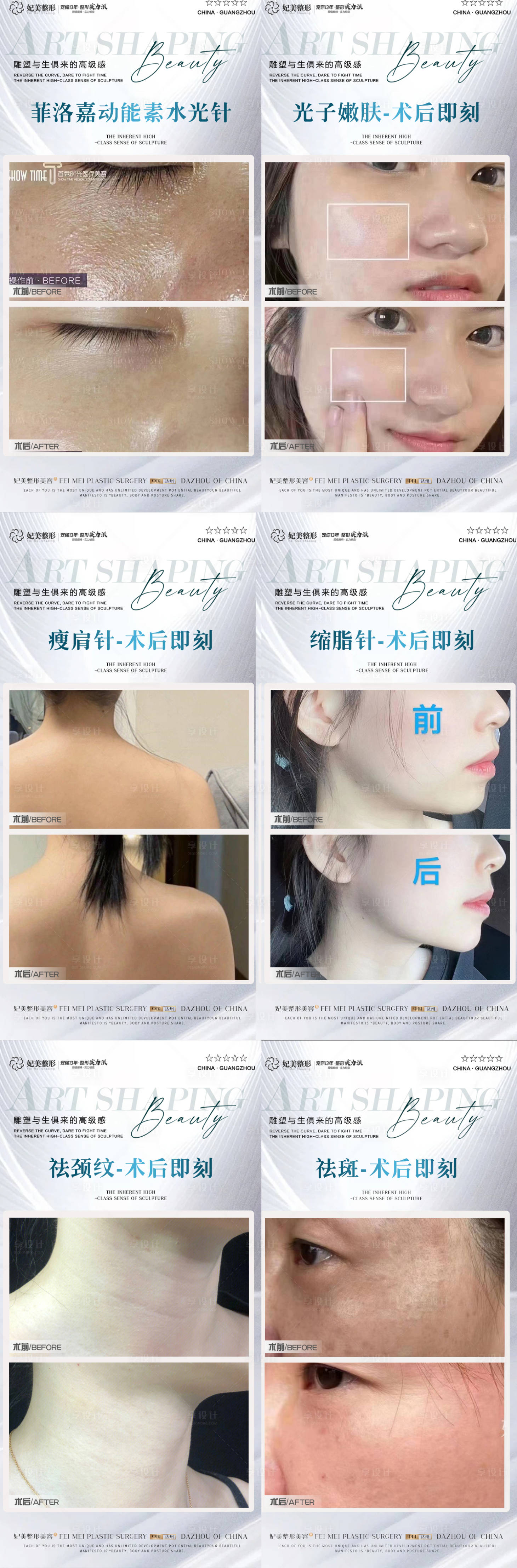源文件下载【医美皮肤项目案例集】编号：81340015553887922