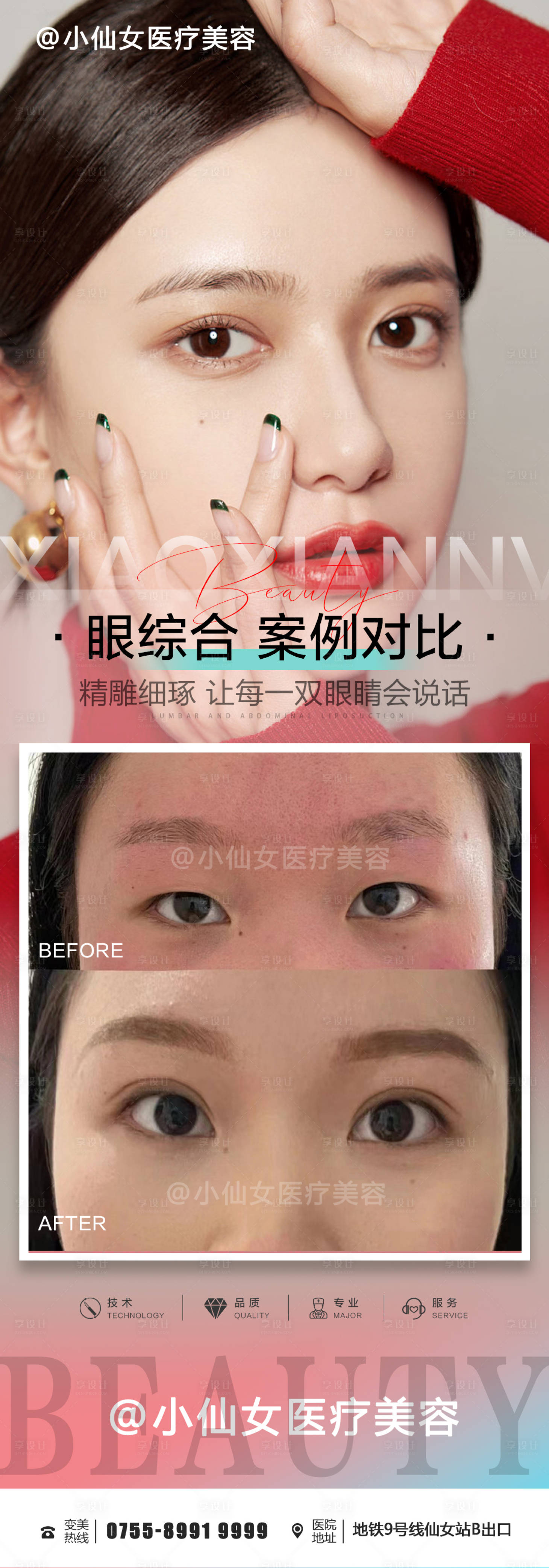 源文件下載【享設計】搜索編號：38860015177678067【眼綜合案例對比海報】