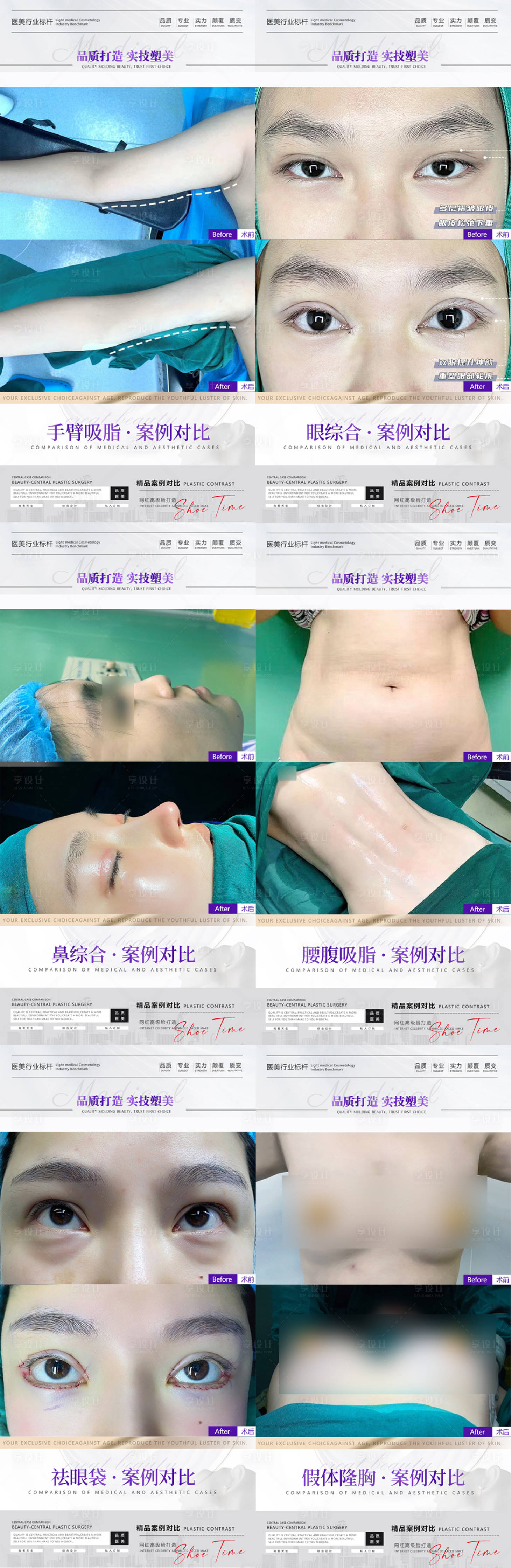 源文件下载【医美案例系列海报】编号：17610015674422767