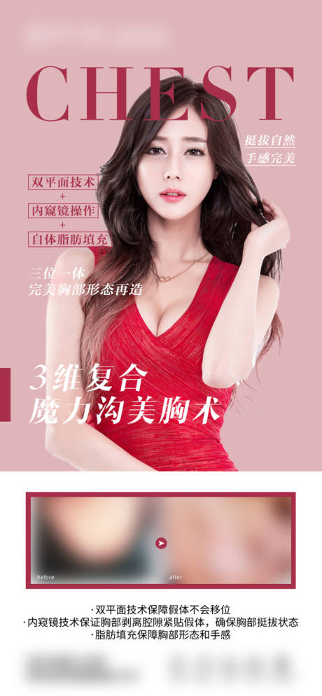 源文件下载【医美胸部杂志风海报】编号：72580015700345539