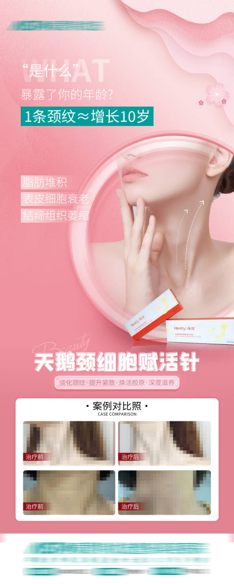 源文件下载【天鹅颈案例海报】编号：99980015238899298