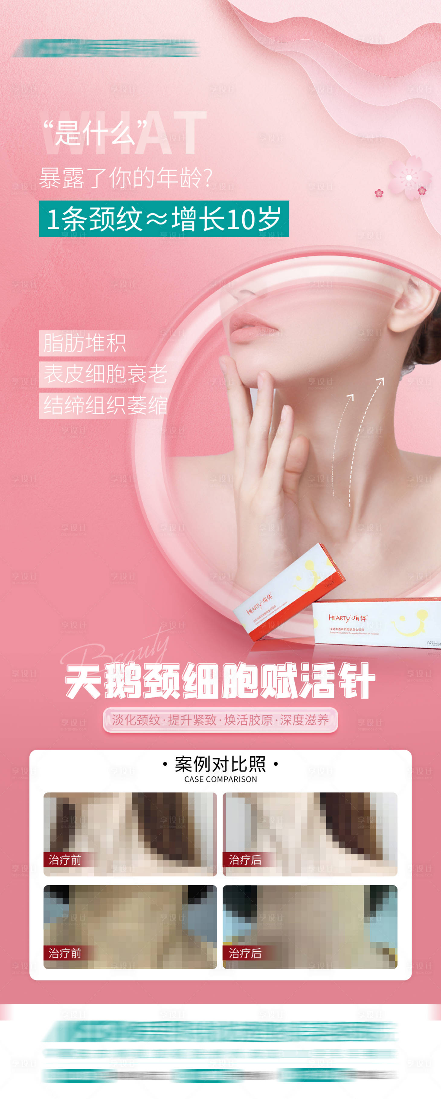 源文件下载【天鹅颈案例海报】编号：99980015238899298