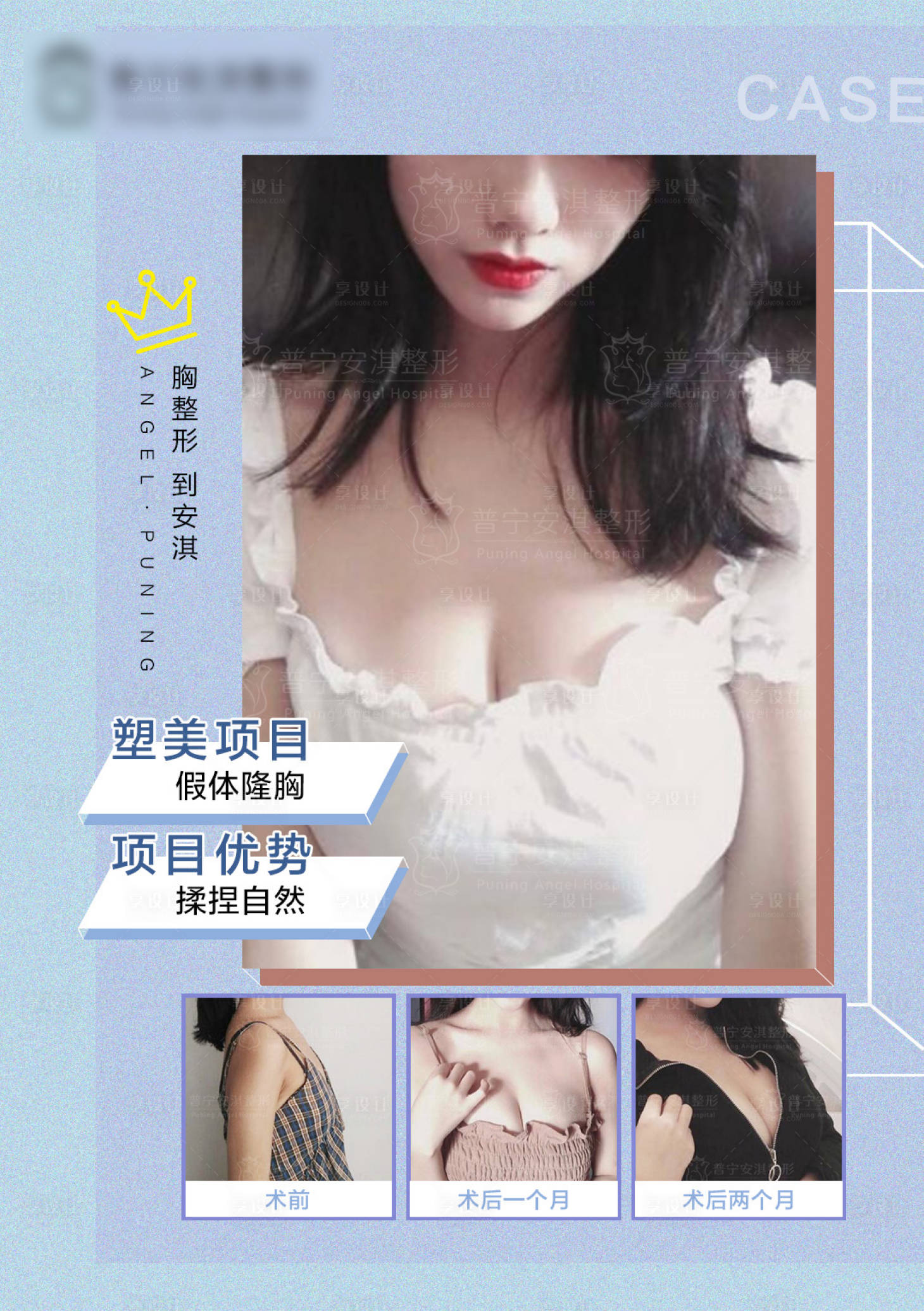 源文件下载【享设计】搜索编号：25390015361323025【医美案例】