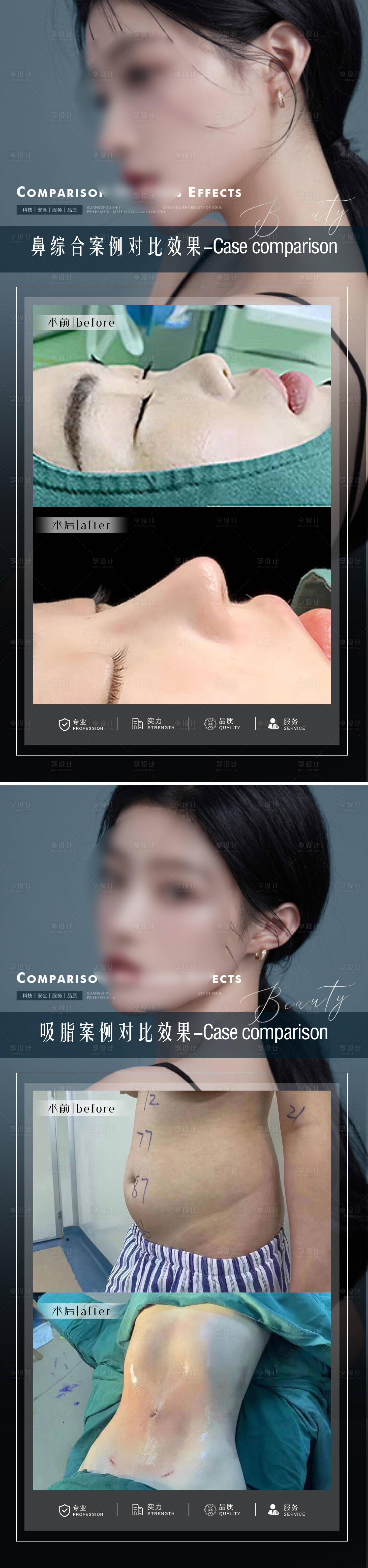 源文件下载【享设计】搜索编号：65190015488699463【医美案例整形对比图】