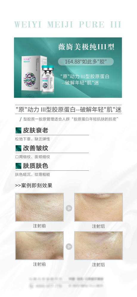 源文件下載【享設計】搜索編號：99100015433541762【薇旖美III型膠原蛋白海報推圖】