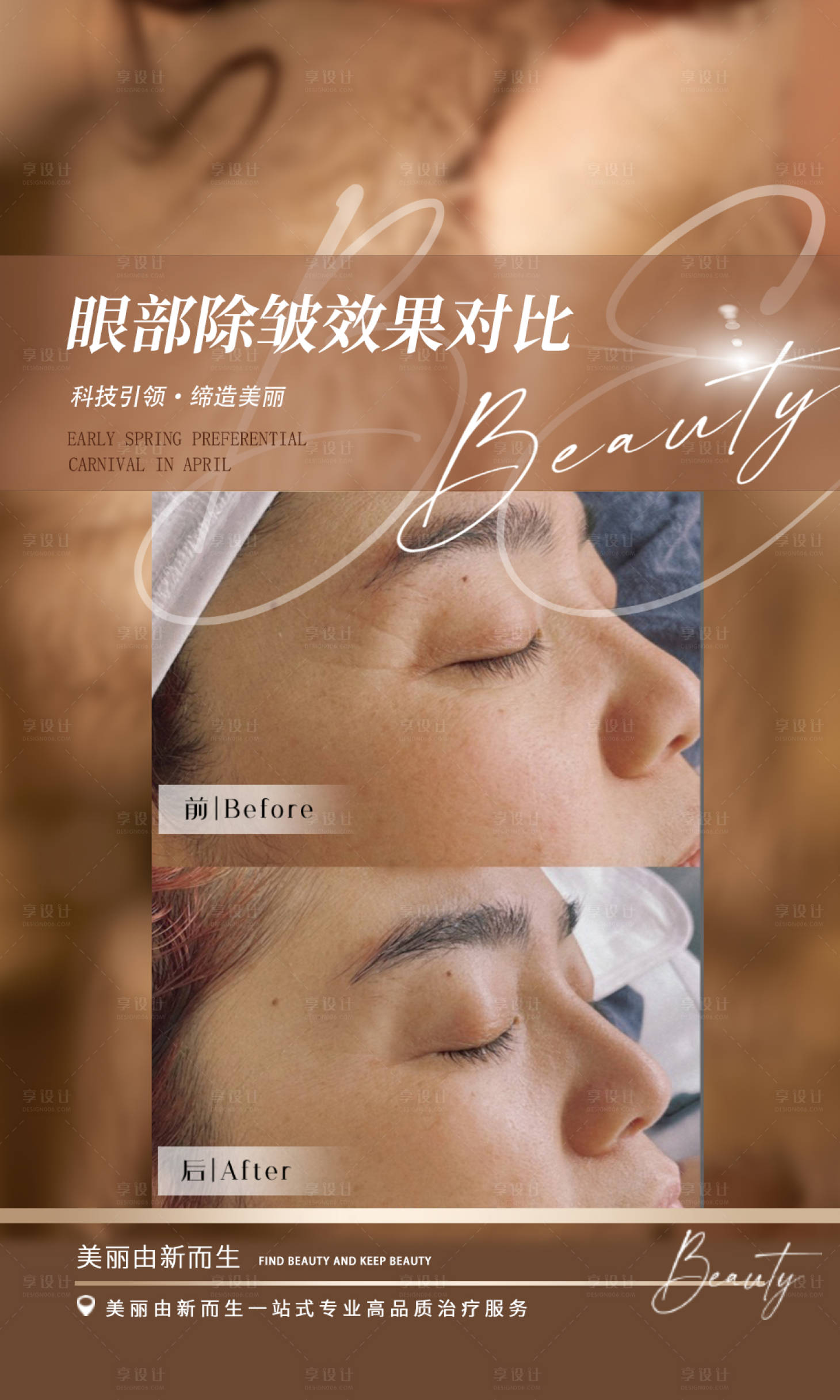 源文件下载【嗨体祛颈纹案例】编号：73280015153704115