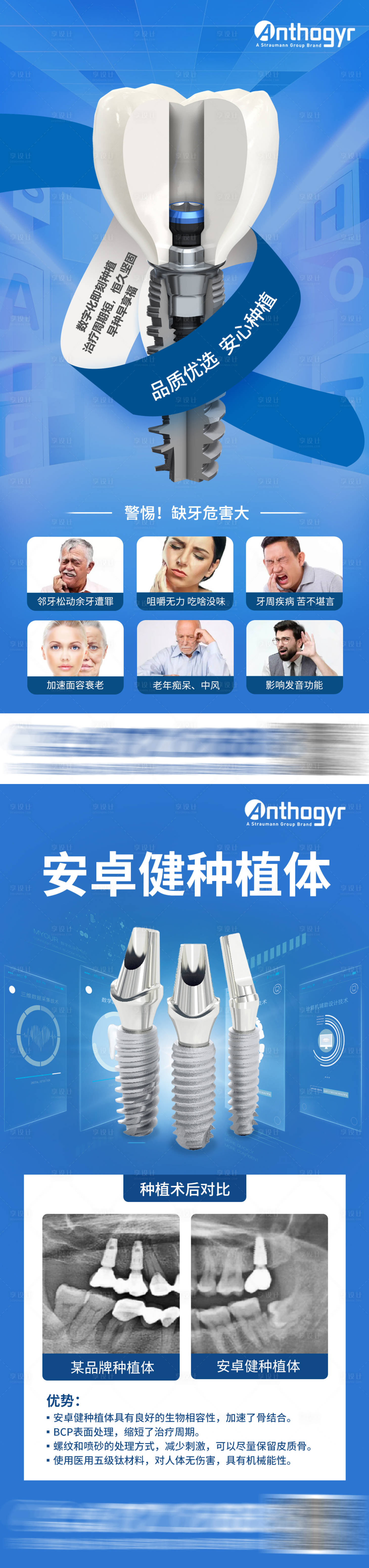 源文件下载【种植体种植牙海报】编号：17570015377098614