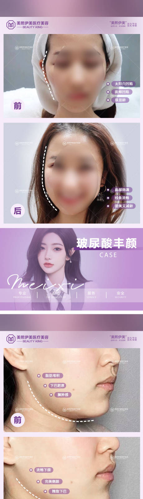 源文件下载【医美案例对比系列海报】编号：95530015381901220