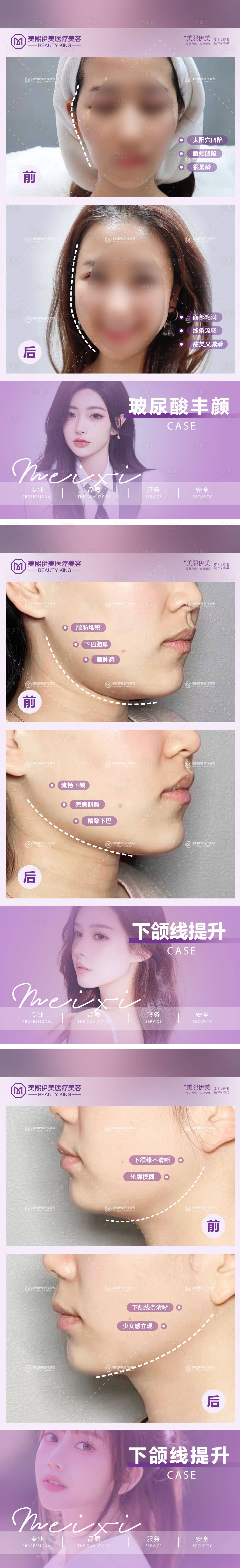 源文件下载【享设计】搜索编号：95530015381901220【医美案例对比系列海报】