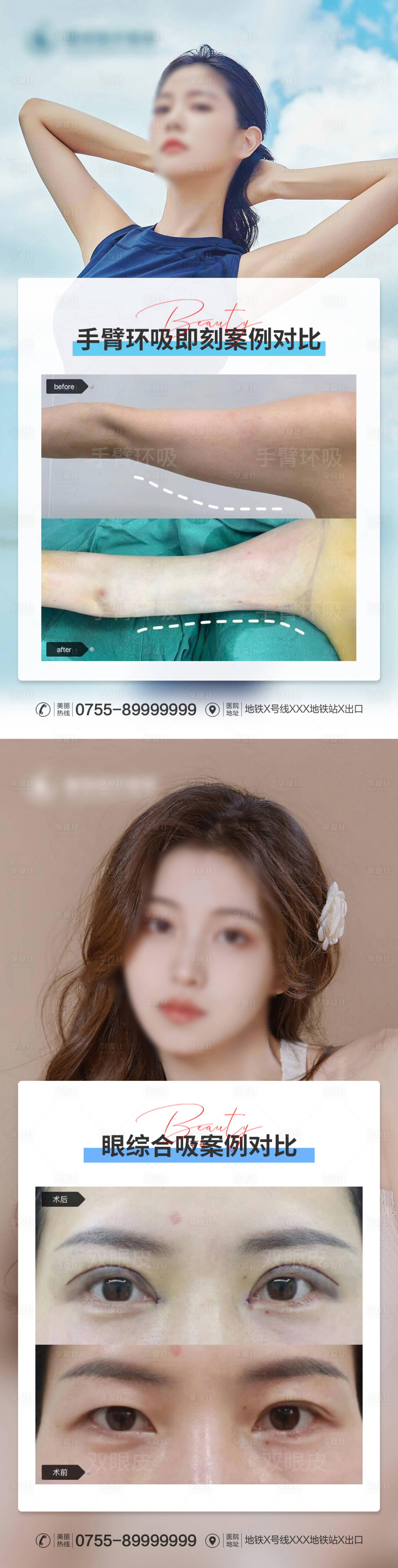 源文件下载【医美案例对比系列海报】编号：80820015369975330