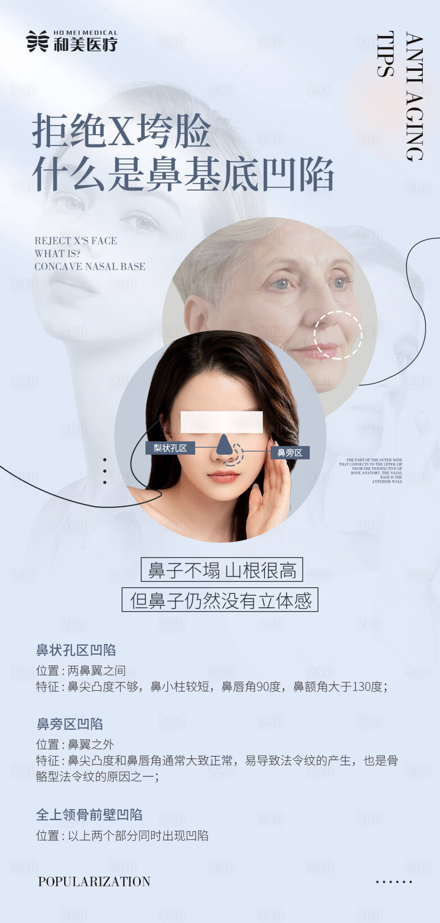 源文件下载【鼻基底凹陷类型科普海报】编号：46660015683792931