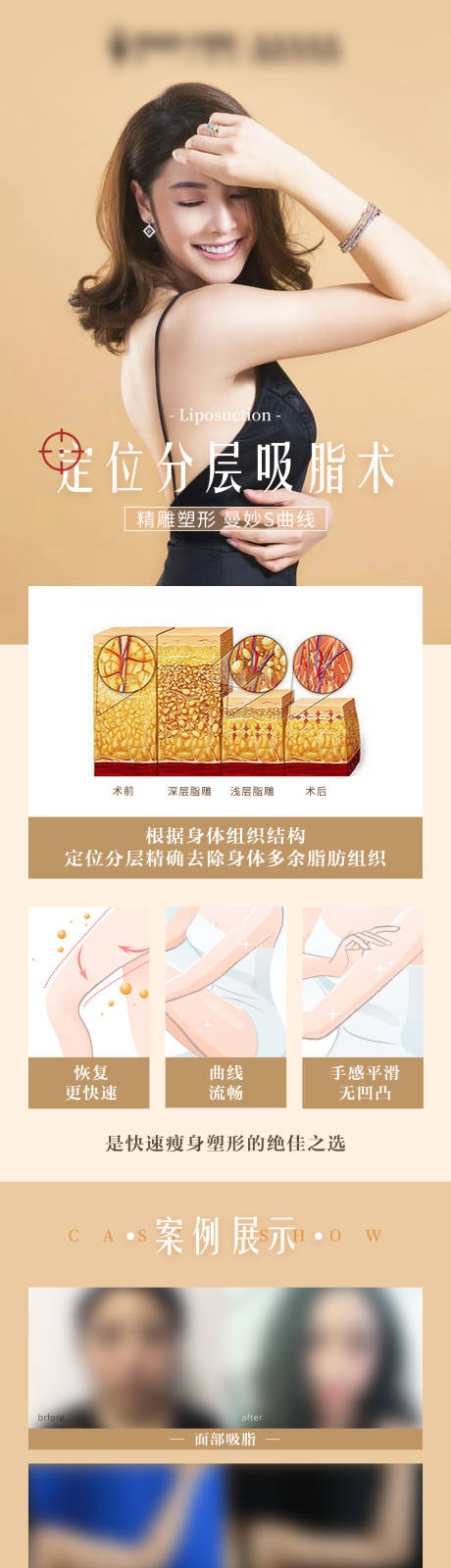 源文件下载【医美吸脂科普案例长图】编号：22010015700421035