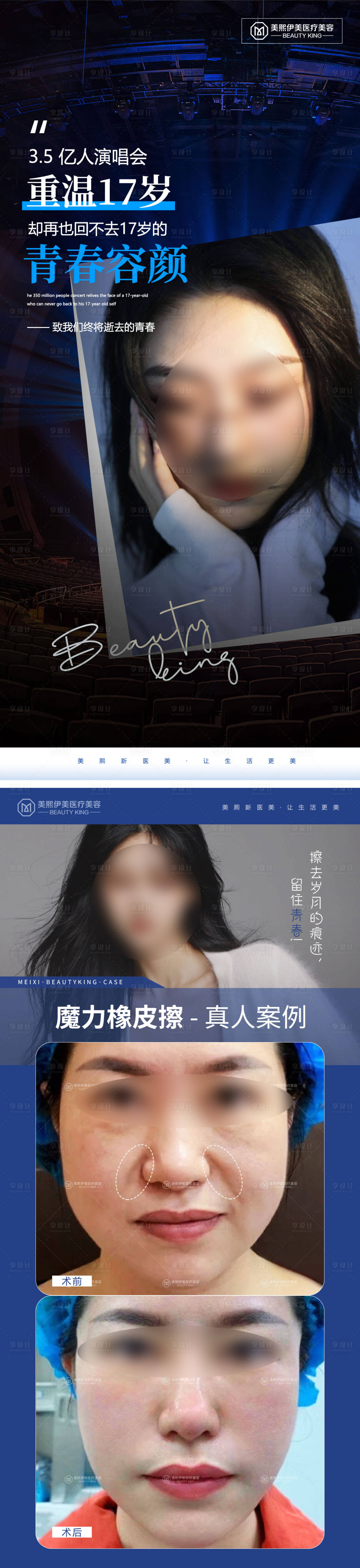 源文件下載【享設(shè)計】搜索編號：15080015370387060【醫(yī)美致青春系列海報】