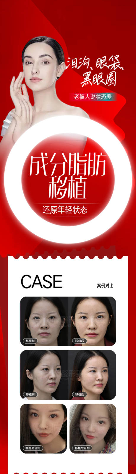源文件下载【整形脂肪长图海报设计】编号：39790015320824586
