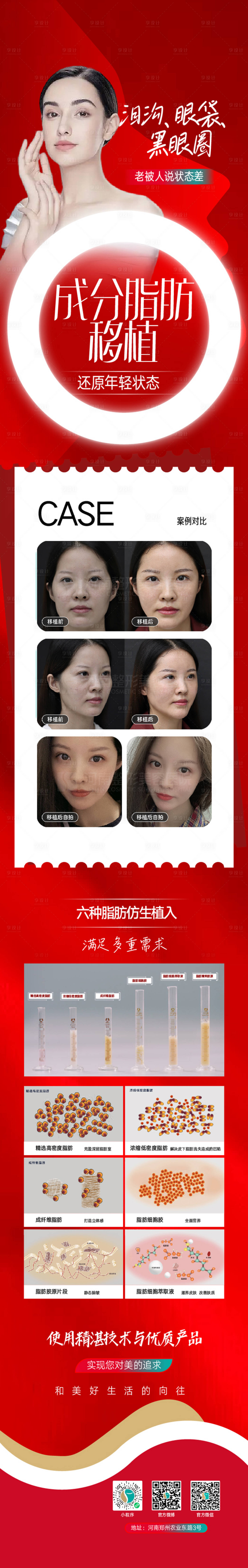 源文件下载【享设计】搜索编号：39790015320824586【整形脂肪长图海报设计】