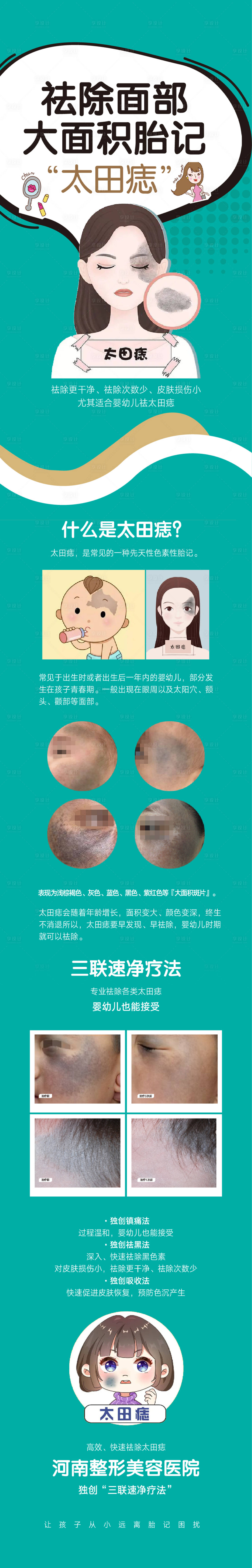 源文件下载【享设计】搜索编号：24990015293695359【袪太田痣长图海报】