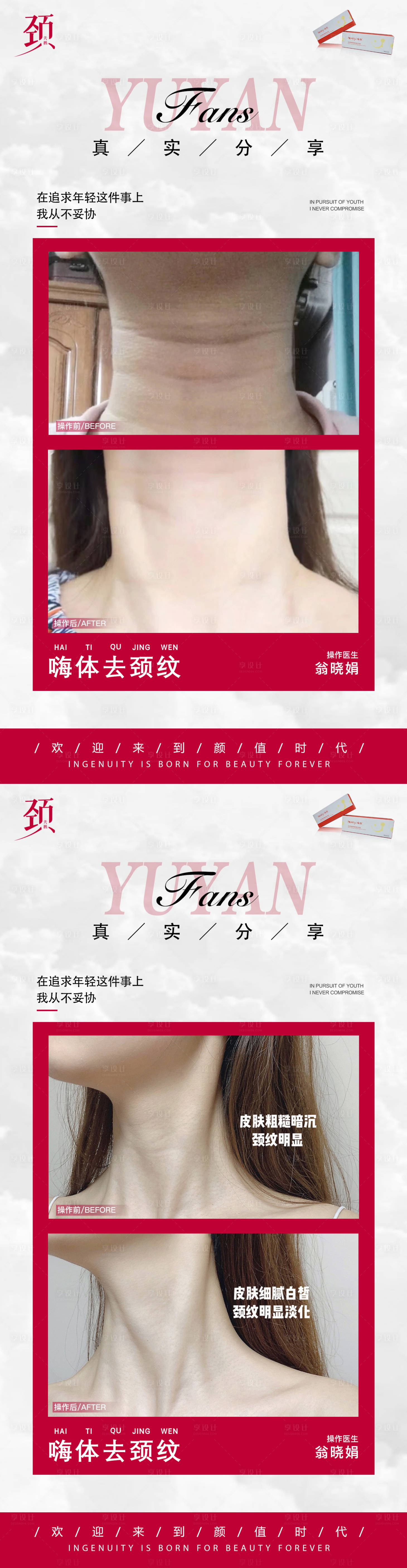 源文件下载【享设计】搜索编号：38510015558796422【医美颈纹案例海报】