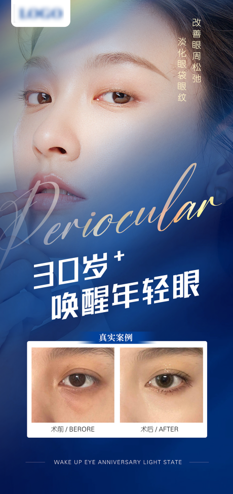 源文件下载【眼周案例对比海报】编号：87720015529152001