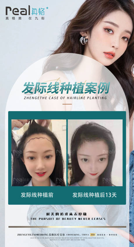 源文件下载【医美植发案例对比图】编号：25480015658273075