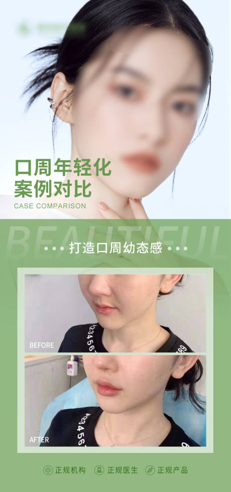 源文件下载【医美案例对比】编号：91860015623572893