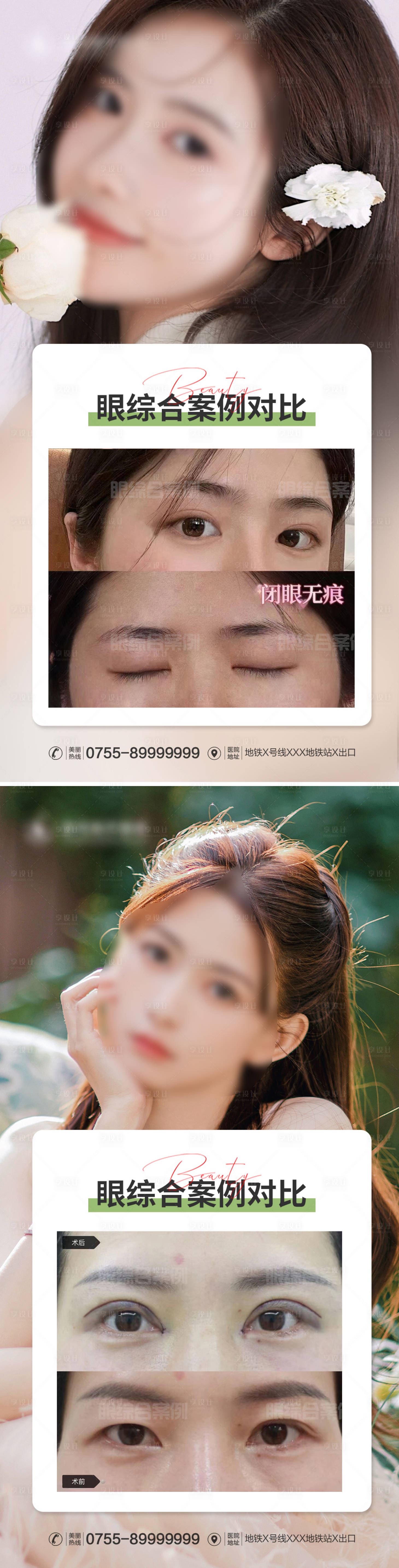 源文件下載【享設計】搜索編號：59480015440746866【醫美眼綜合案例對比】