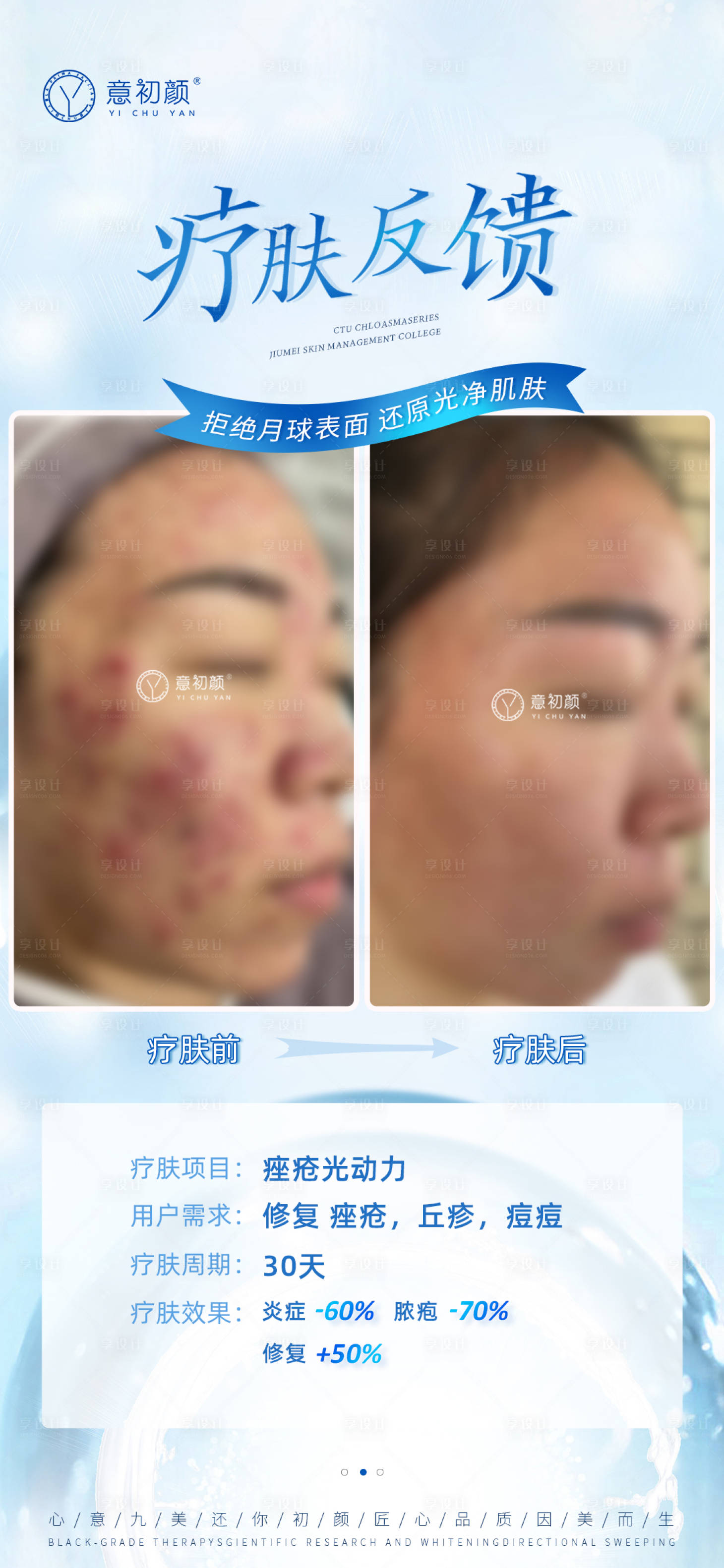 源文件下载【享设计】搜索编号：17090015288694145【医美祛斑对比简约海报】