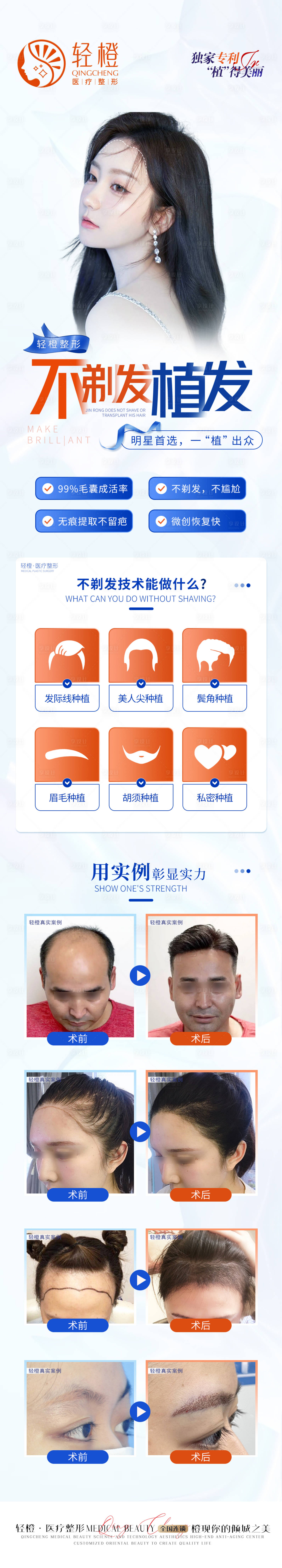 源文件下载【不剃发植发海报】编号：91890015219876098