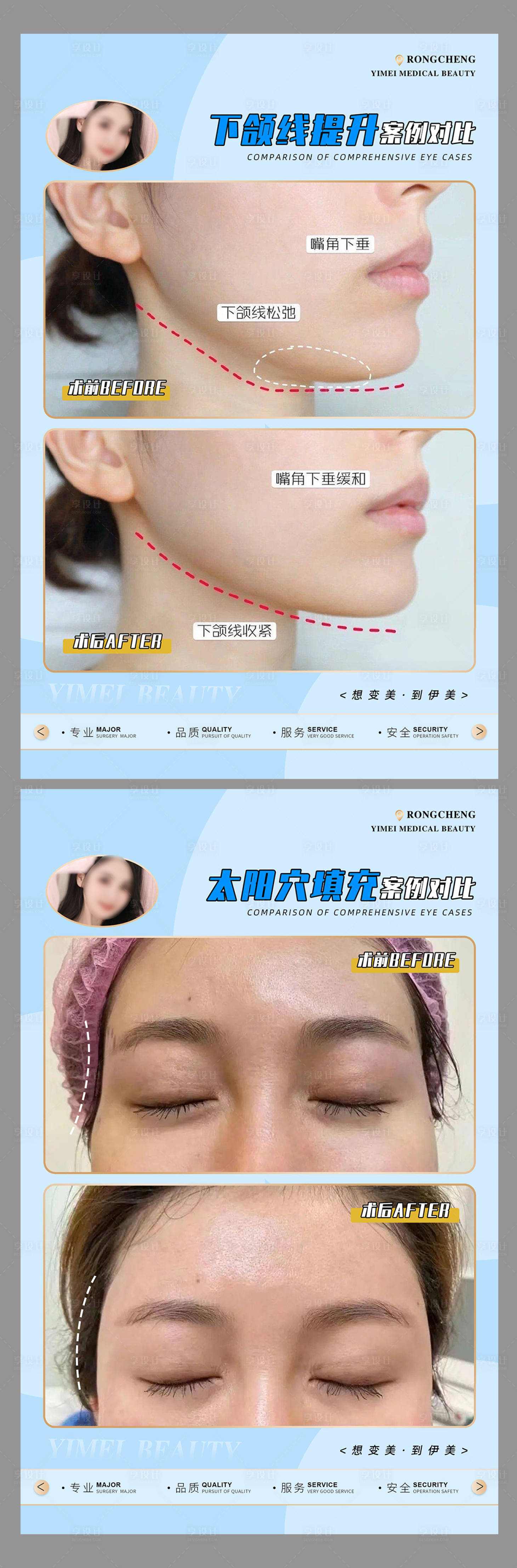 源文件下载【享设计】搜索编号：95620015760181323【医美案例模板】