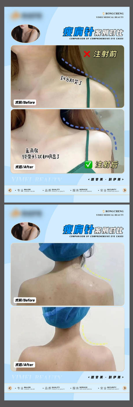 源文件下载【医美案例模板】编号：76230015679837422