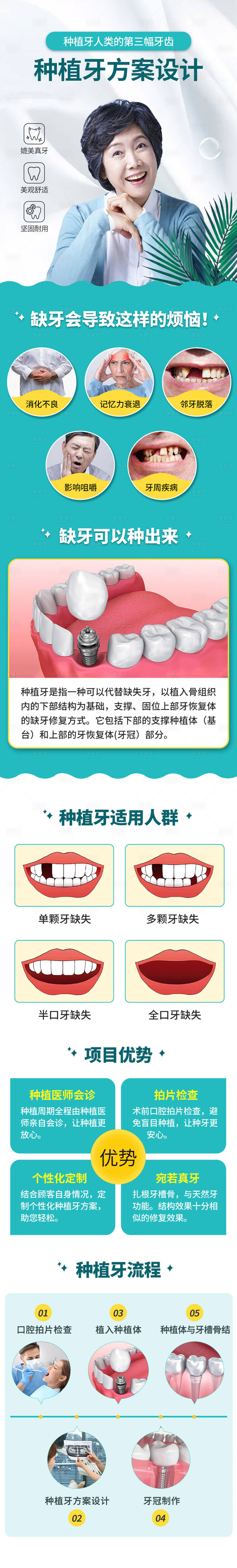 源文件下載【享設(shè)計(jì)】搜索編號(hào)：47360015056095760【口腔種植牙活動(dòng)電商詳情頁(yè)】