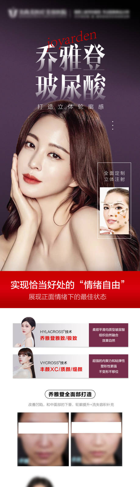 源文件下载【乔雅登玻尿酸】编号：69720015645484694