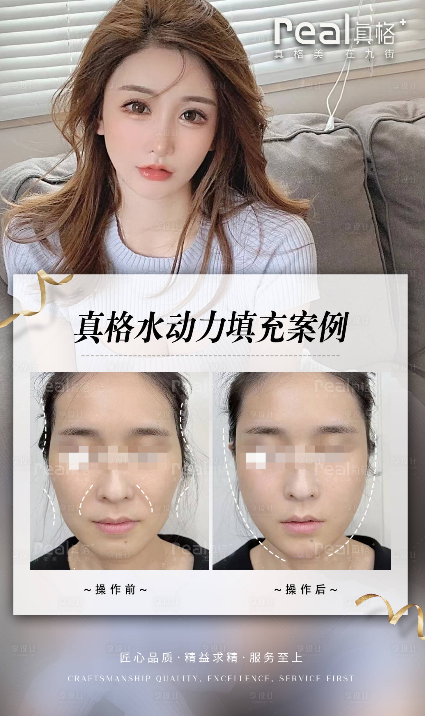 源文件下載【享設計】搜索編號：41410015658125366【醫美案例對比圖】