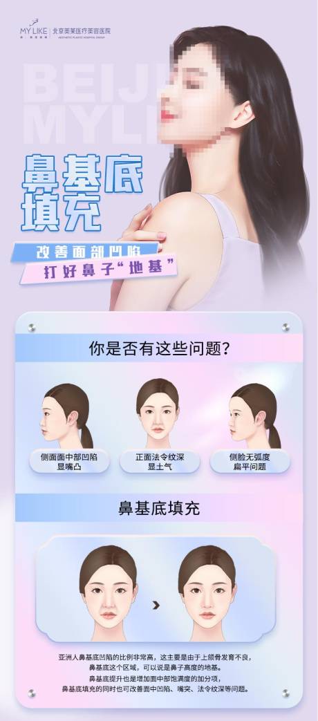 源文件下载【医美鼻基底填充海报】编号：20230329104014101