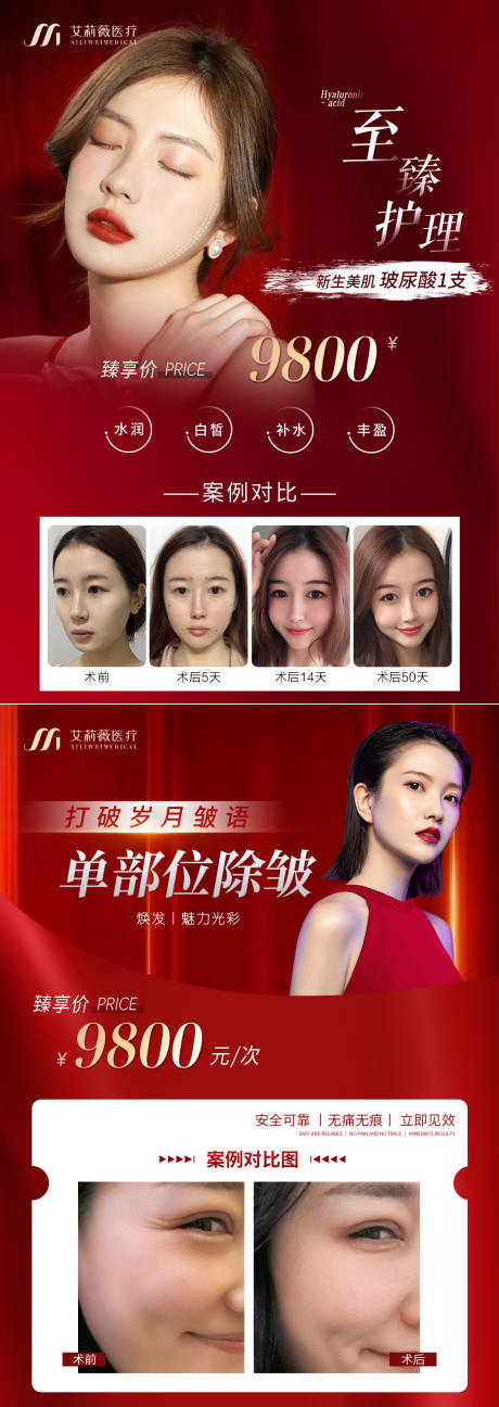 源文件下载【医美案例对比海报】编号：85110015398538477
