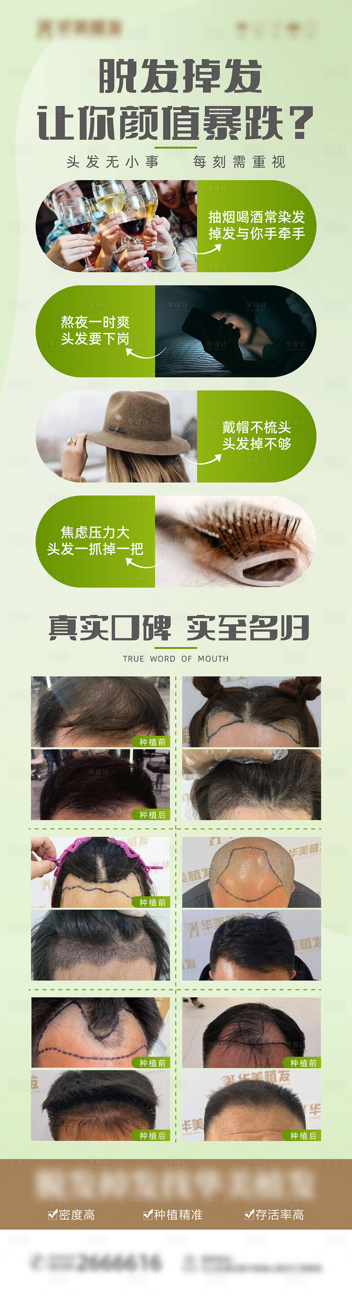 源文件下載【享設計】搜索編號：66510015302422625【脫發掉發案例對比海報】