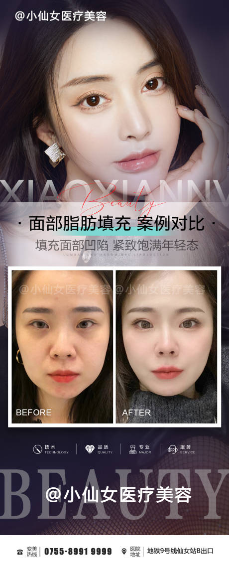源文件下载【享设计】搜索编号：52220015258238210【医美整形脂肪填充面部案例海报】
