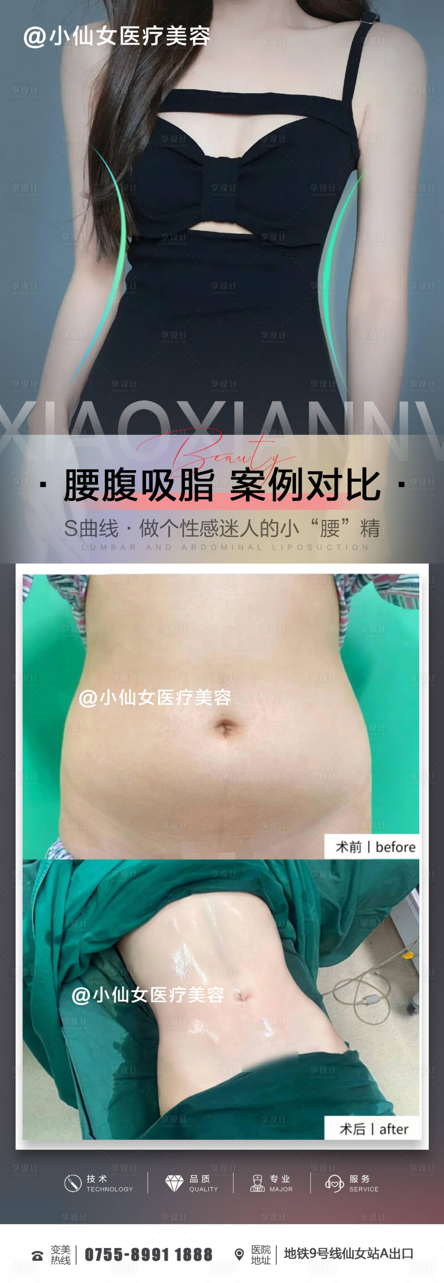 源文件下载【享设计】搜索编号：16280015176308259【医美整形腰腹吸脂朋友圈案例海报】
