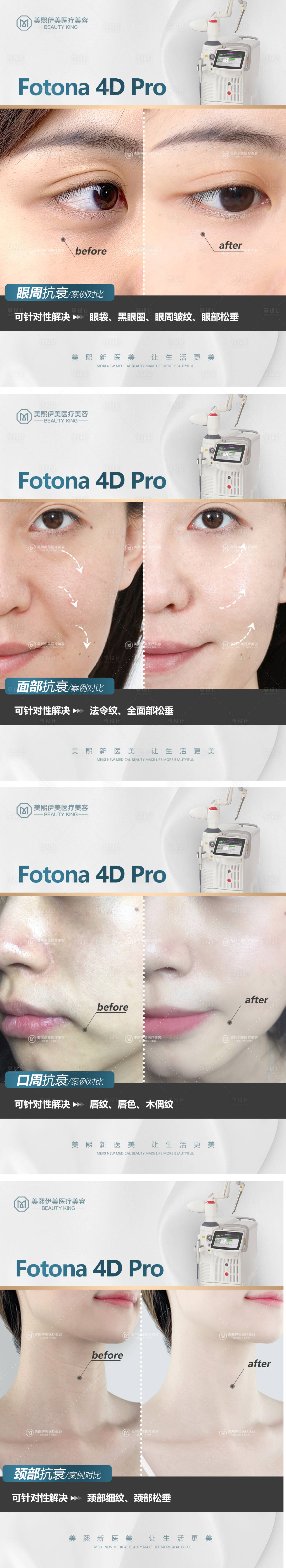 源文件下載【享設計】搜索編號：88430015436766445【歐洲之星案例系列】