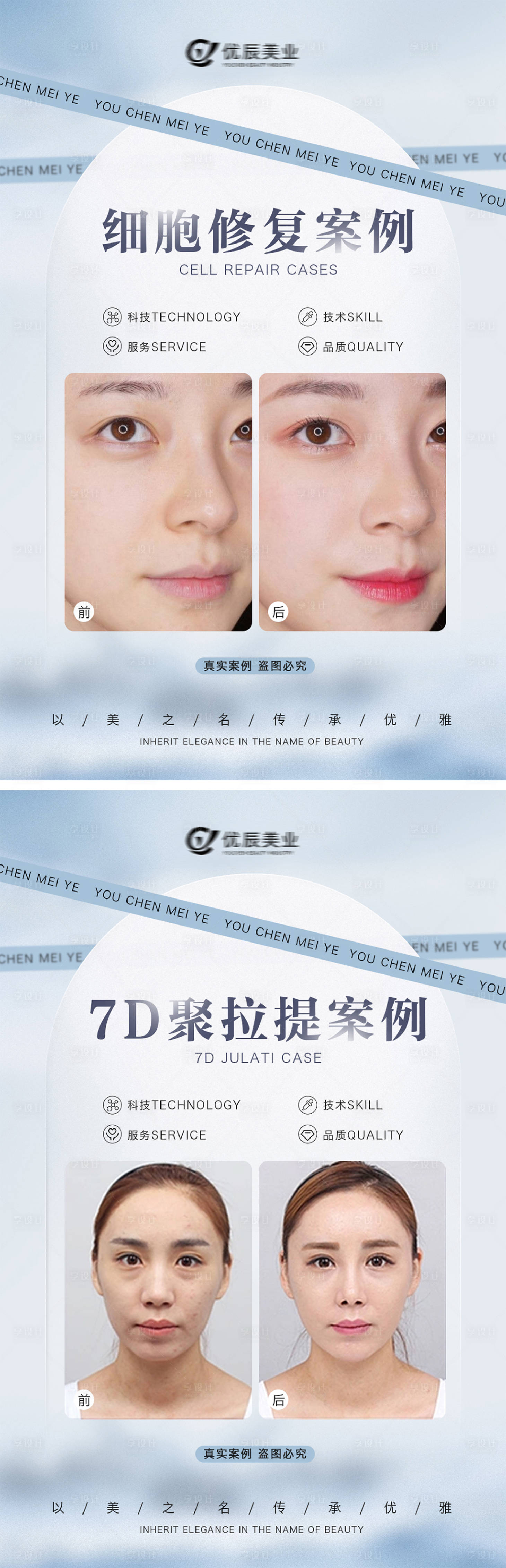 源文件下载【享设计】搜索编号：87120015471662840【医美案例对比系列海报】